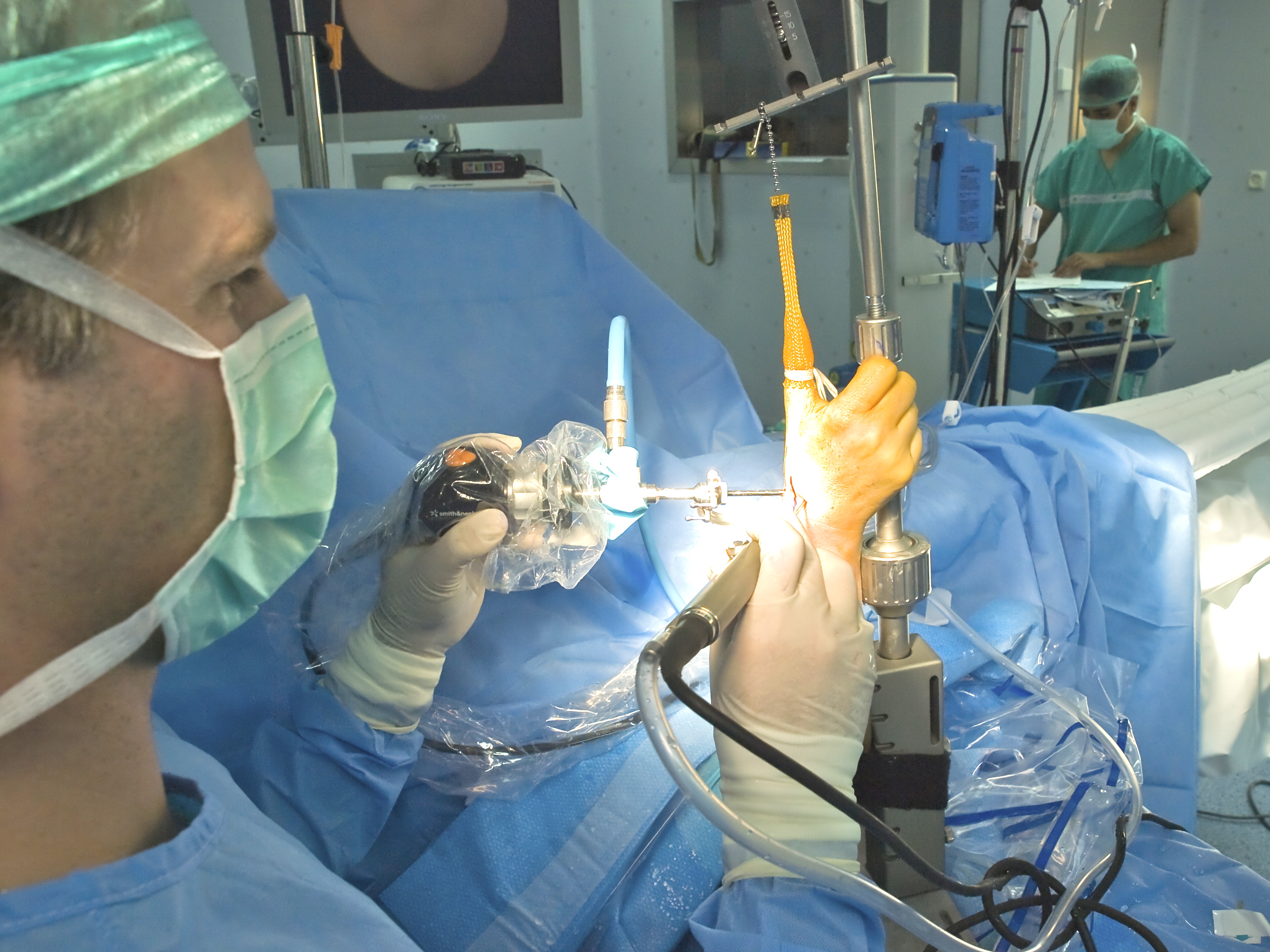 Dolor Intenso en la Base del Pulgar. Rizartrosis