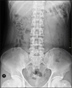 Medical_X-Ray_imaging_ABK02_nevit