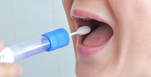 Prevenir la artrosis con una muestra de saliva