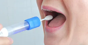 Prevenir la artrosis con una muestra de saliva