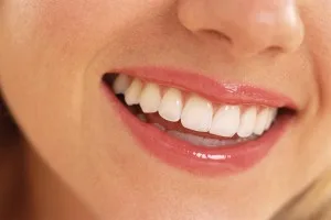 Blanquear los dientes es posible