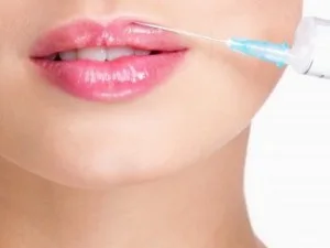 Relleno de labios con ácido hialurónico